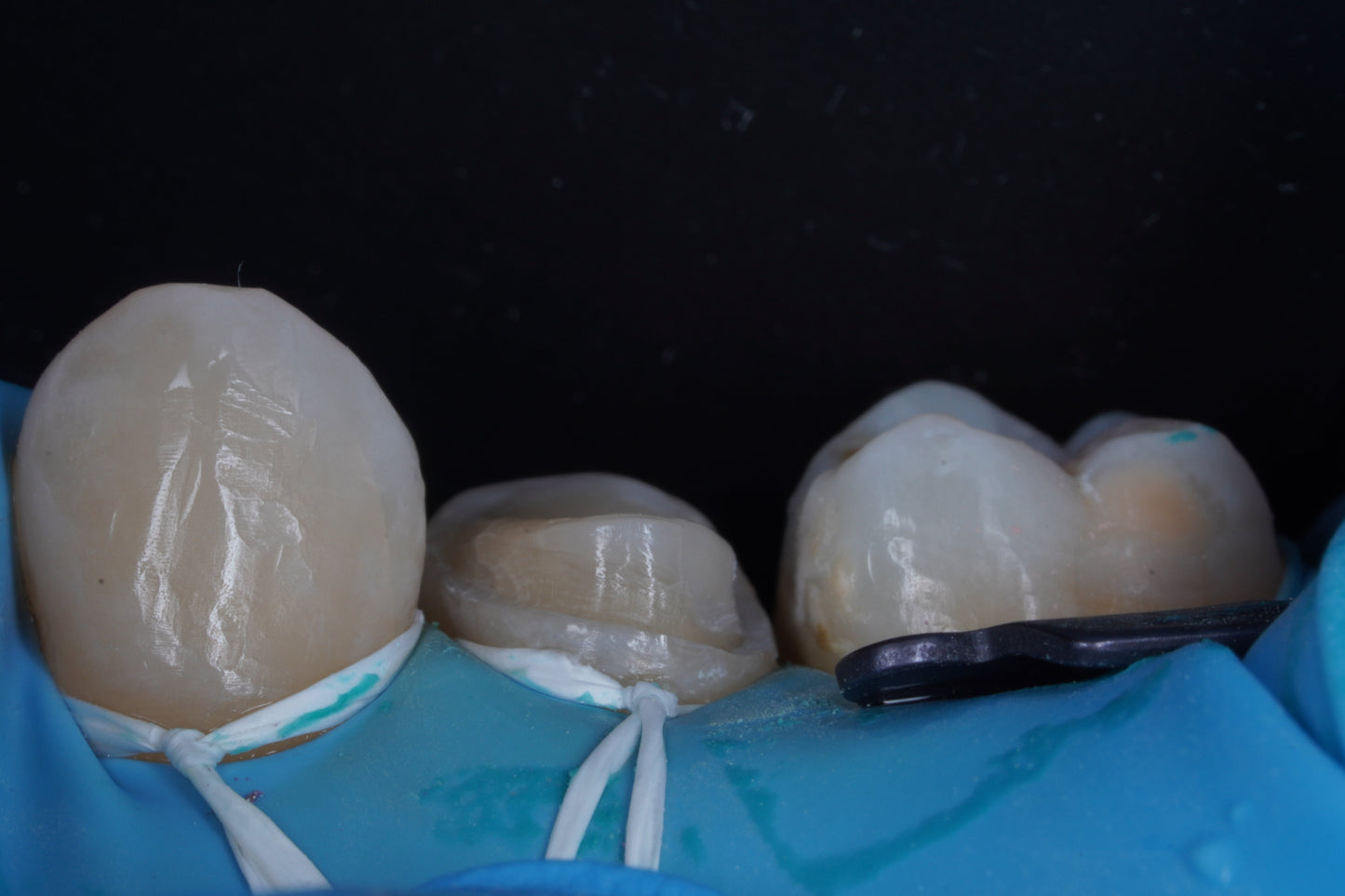 Contraste dental flexible posterior negro - Silicona suave